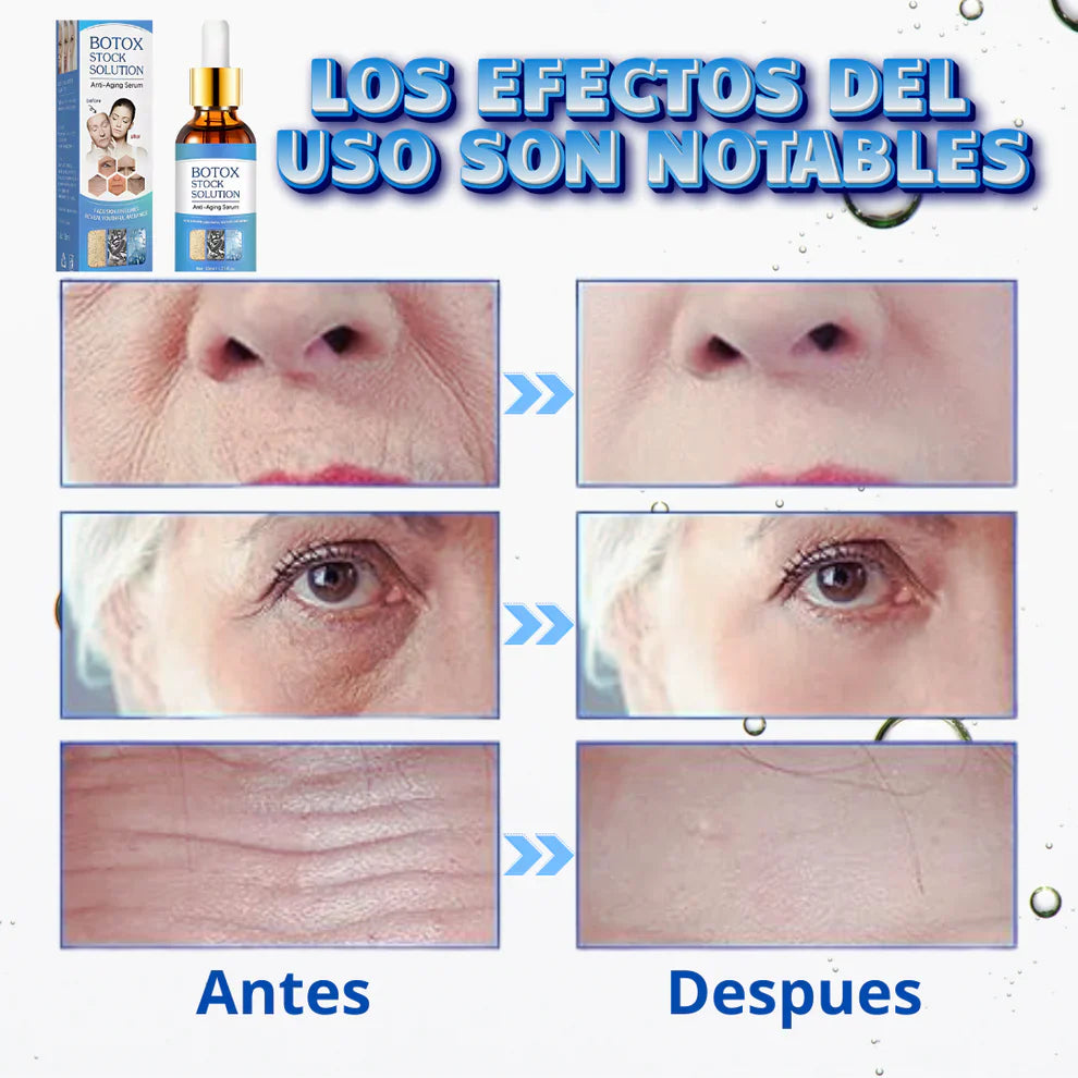 Sérum Magic Botox®