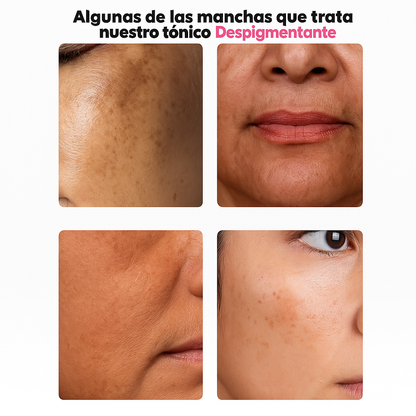 InfiniteDerma® - Sérum Despigmentante